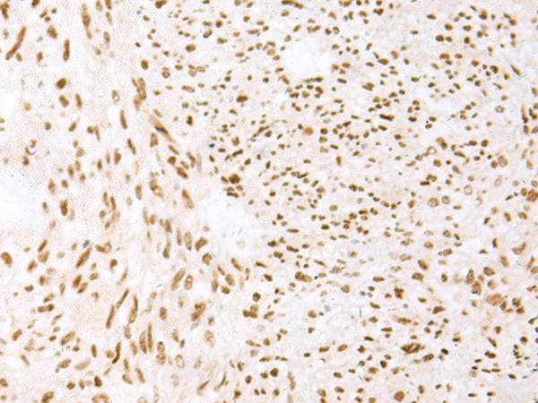 Treacle / TCOF1 Antibody