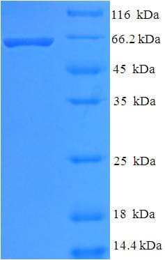 Human HDAC8 Protein (Recombinant His-SUMO)