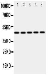 Polyclonal Rabbit anti-Human IRF3 Antibody (aa409-427, WB)
