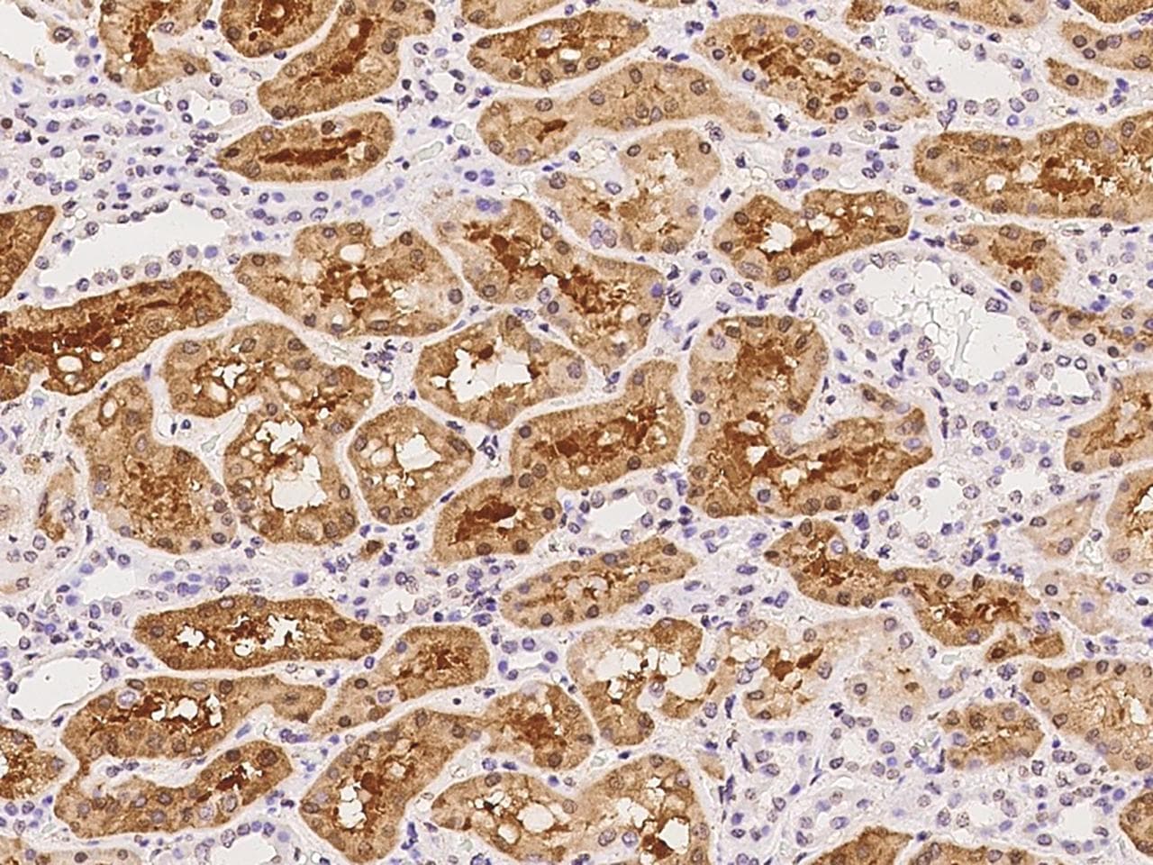 Polyclonal Rabbit anti-Human BBOX1 / BBOX Antibody (IHC)