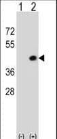 DAPK2 / DAP Kinase 2 Antibody (aa38-65)