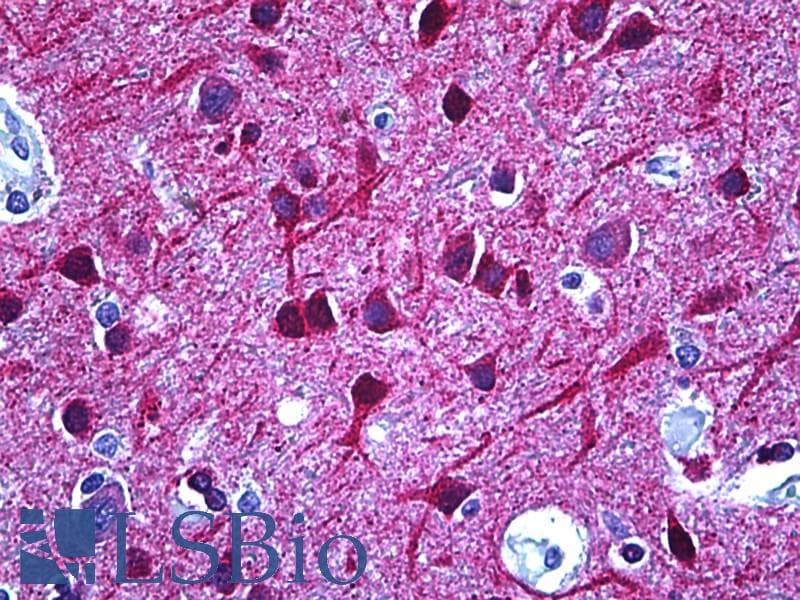 IHC-plus™ DPYSL2 / CRMP2 Antibody (aa480-529)