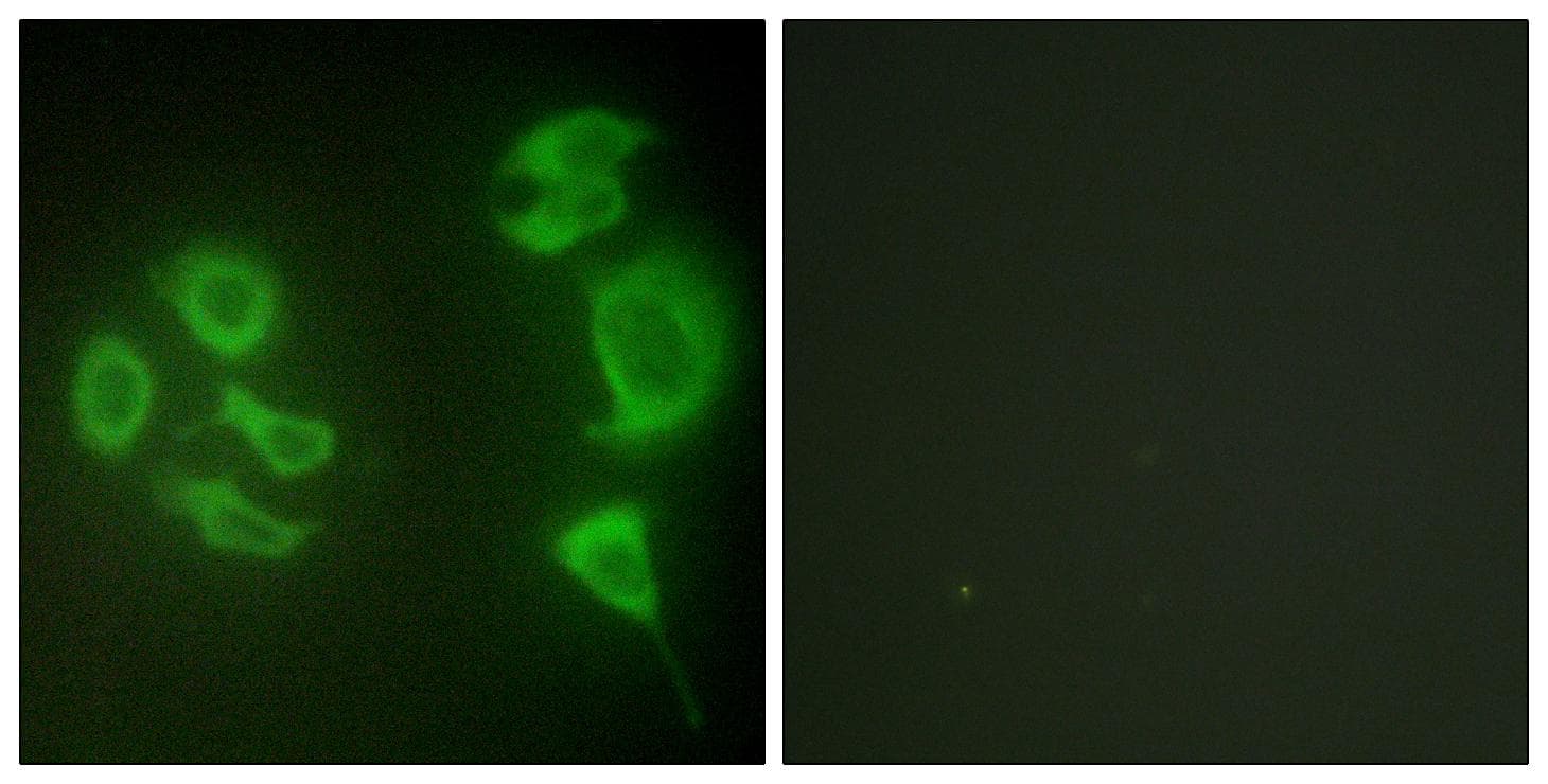 ZAK / MLTK Antibody