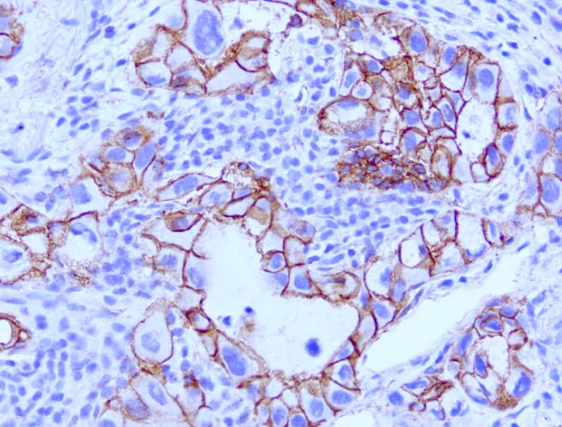 Monoclonal Mouse anti-Human CTNNB1 / Beta Catenin Antibody (clone UMAB15, Carrier-free, IHC, IF, WB)