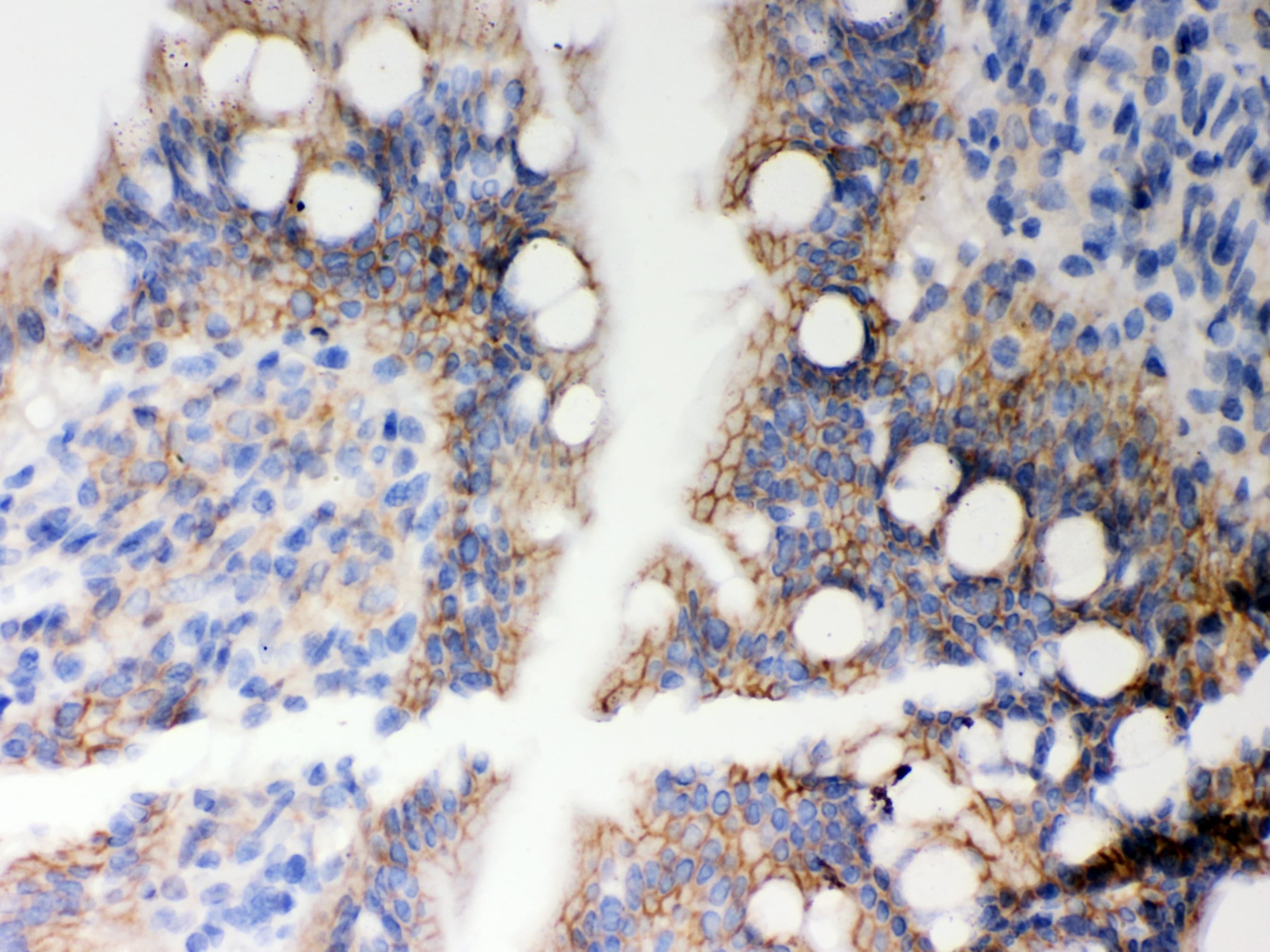 HLA-A Antibody (aa82-106)