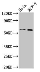 Polyclonal Rabbit anti-Human MMP28 Antibody (IHC, IF, WB)
