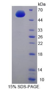 Human CCNA1 / Cyclin A1 Protein (Recombinant His-GST)