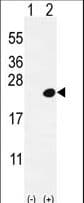 DOK5 Antibody (aa276-306)