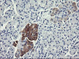FTCD / 58K Golgi Protein Antibody (clone OTI1A7)