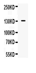 NOS2 / iNOS Antibody