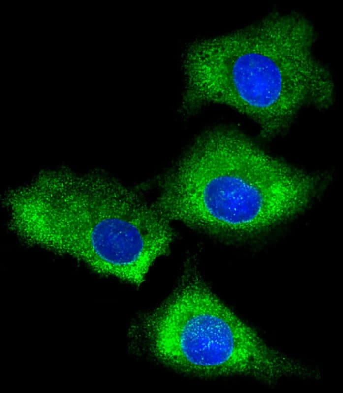 RPS7 / Ribosomal Protein S7 Antibody (C-Terminus)