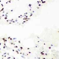 RNGTT / HCAP Antibody