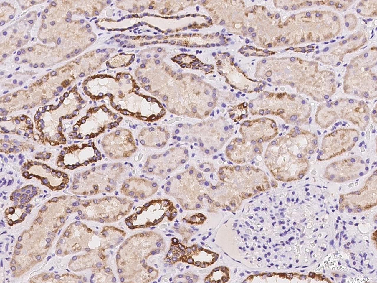 METTL9 / PAP1 Antibody