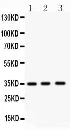 NKX2-5 Antibody (aa103-132)