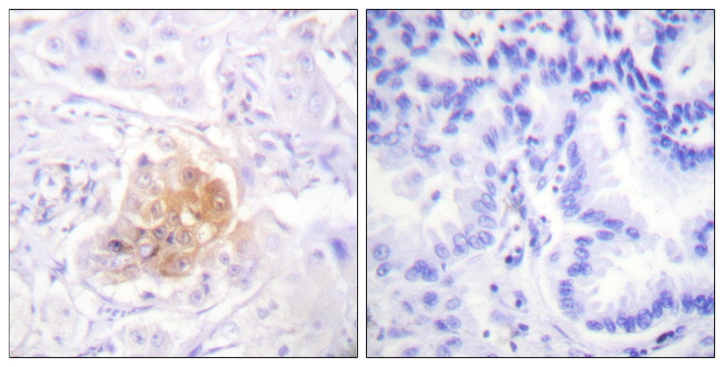 IL2RB / CD122 Antibody (p364)