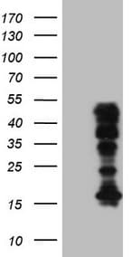 Monoclonal Mouse anti-Human HOXC10 Antibody (clone OTI5C10, aa1-262, IHC, WB)