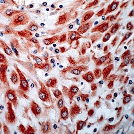 FLT4 / VEGFR3 Antibody (C-Terminus)