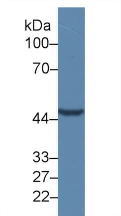 TMEFF1 / Tomoregulin 1 Antibody (aa58-312)
