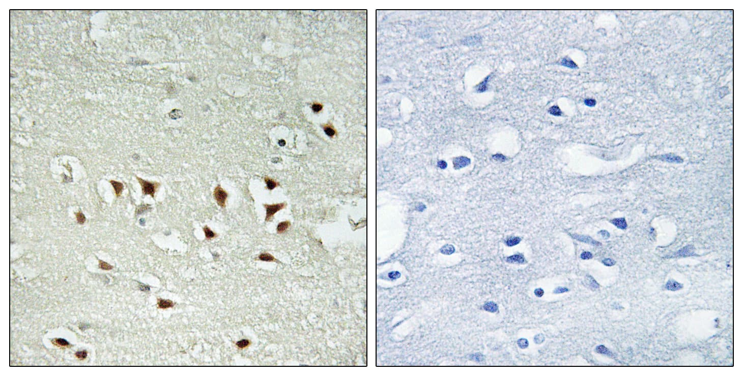 MAPKAPK2 / MAPKAP Kinase 2 Antibody (phospho-Thr334)