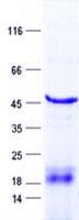 Human RNF146 Protein (Recombinant His, N-Terminal)