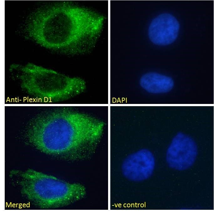 PLXND1 / Plexin D1 Antibody (aa1683-1694)