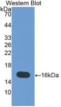 TNC / Tenascin C Antibody (aa49-181)