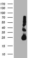 TIMP2 Antibody (clone OTI2G7)