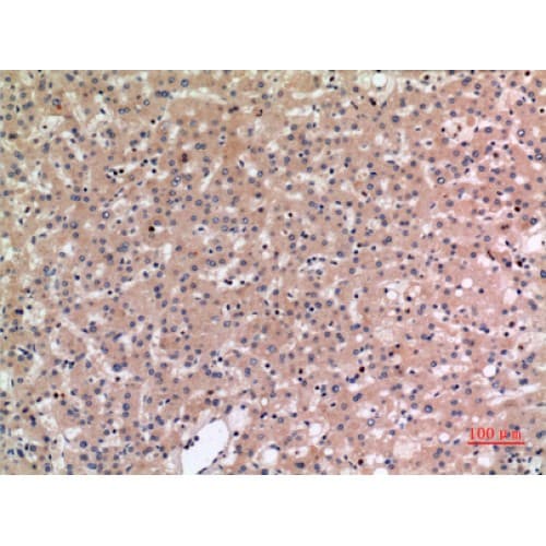 Polyclonal Rabbit anti-Human SLC10A1 / NTCP Antibody (281-330 aa, C-terminal, IHC, WB)
