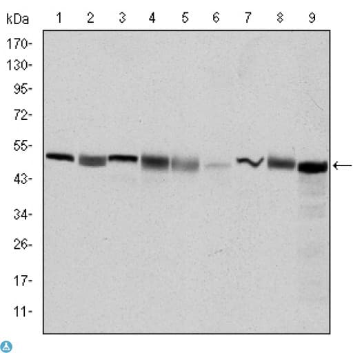 Monoclonal Mouse anti-Human CCT2 / CCT Beta Antibody (WB)