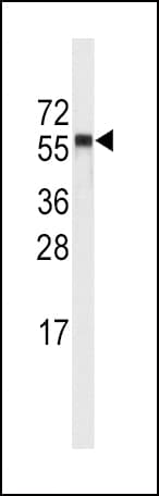 CYP4A11 Antibody (aa407-435)