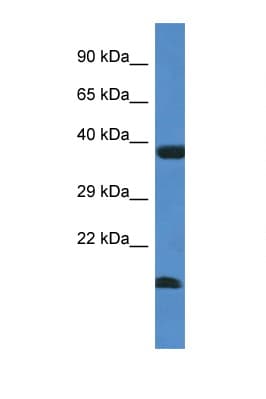 Polyclonal Rabbit anti-Human UEV1 / UEV1A Antibody (N-Terminus, WB)