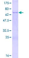 Human PDSS2 / DLP1 Protein (Recombinant GST)