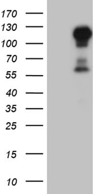 Monoclonal Mouse anti-Human GLI / GLI1 Antibody (clone OTI2A7, aa755-1106, WB)