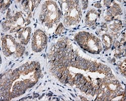 APP / Beta Amyloid Precursor Antibody (clone OTI5C5)