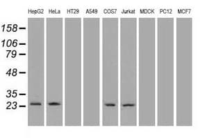 NEUROG1 / NGN1 / Neurogenin 1 Antibody (clone OTI10B10)