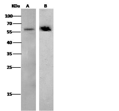 Monoclonal Rabbit anti-Human CD4 Antibody (clone 104, Preservative Free, WB)