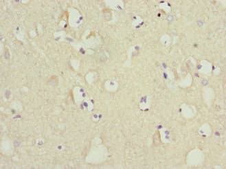 MTCH1 Antibody
