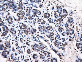 ATP5B / ATP Synthase Beta Antibody (clone OTI4E5)