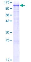 Human FGFR1 / FGF Receptor 1 Protein (Recombinant GST)