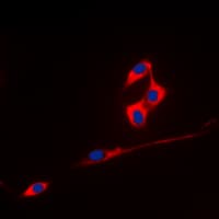 TMPRSS3 Antibody (C-Terminus)