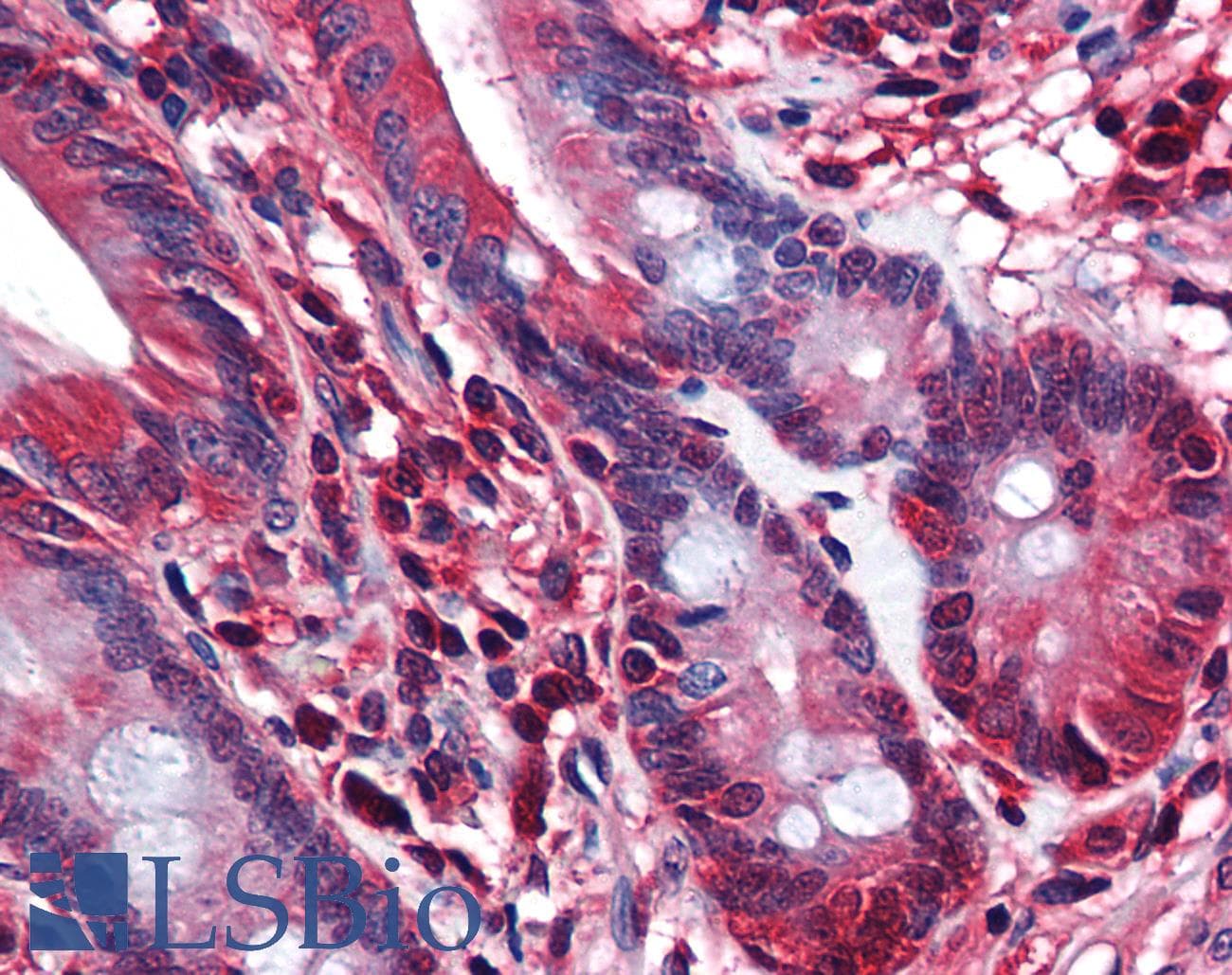 IHC-plus™ STI1 / STIP1 Antibody (clone 2E11)