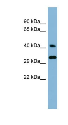 DNAJC27 Antibody (aa143-192)