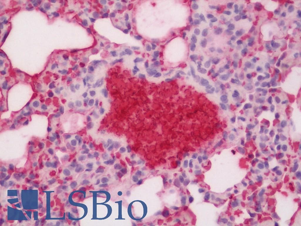 IHC-plus™ Hemoglobin Antibody
