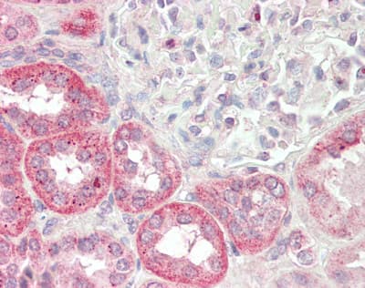 KLHL25 Antibody (aa68-117)