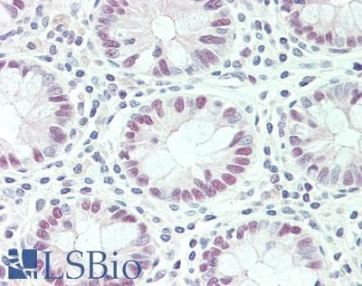 IHC-plus™ N-CoR / NCOR1 Antibody (aa2000-2050)