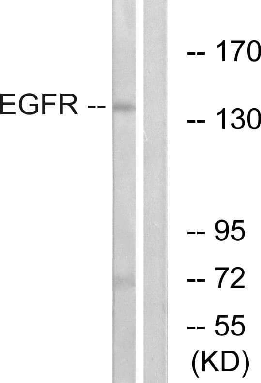 EGFR Antibody (aa1161-1210)