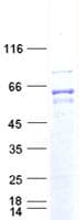 Human THRA / THR Alpha Protein (Recombinant DDK,C-terminus)