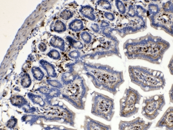 Polyclonal Rabbit anti-Human CYGB / Cytoglobin Antibody (IHC, WB)