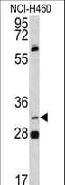 Polyclonal Rabbit anti-Human PITX1 Antibody (aa123-150, WB)