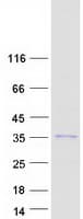Human RPS2P40 Protein (Recombinant Myc-DDK (Flag))
